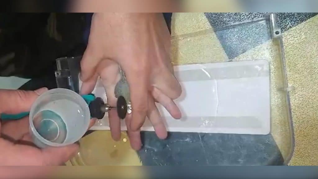 Xaçmazda barmağında üzük qalan qadın Fövqəladə Hallar Nazirliyinə müraciət edib