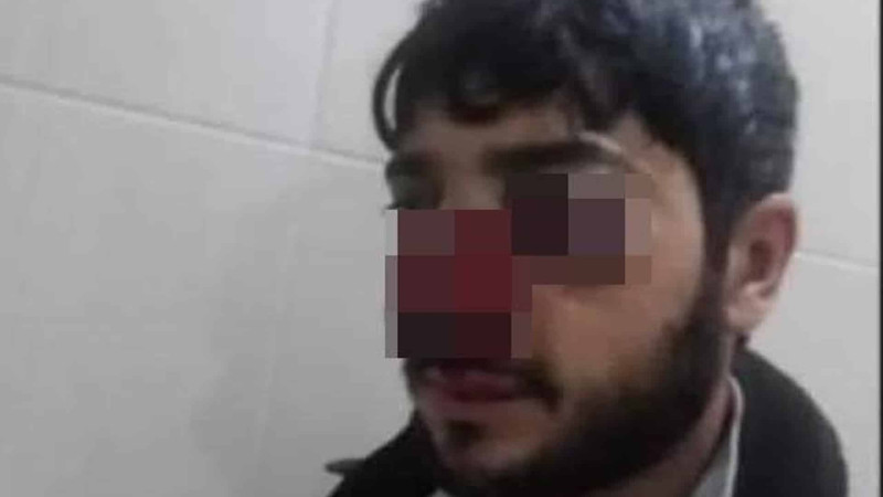Quba: meşəbəyinin döyülməsi barədə qurumlardan açıqlama verilib