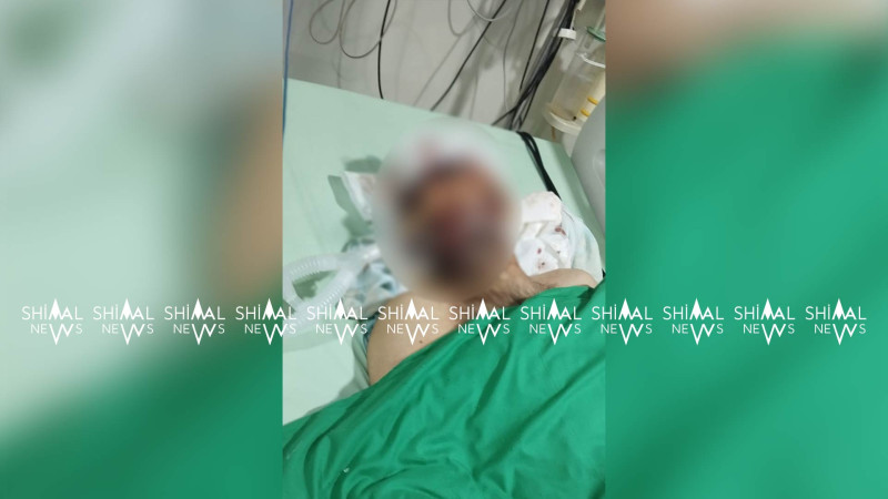 Quba-Qusar yolunda qəzaya düşən şəxsin vəziyyəti ağırdır