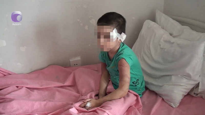 Xudatda uşağını dəmirlə döyən ana xəstəxanaya yerləşdirildi