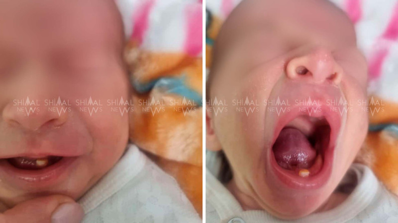 Yeni doğulmuş körpə hamını təəccübləndirdi - FOTO