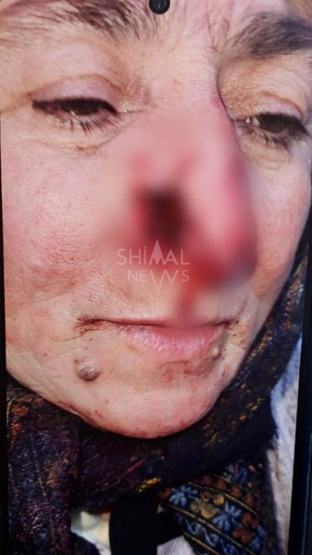 Qubada küçə itləri dəhşət saçdı-FOTO-YENİLƏNİB