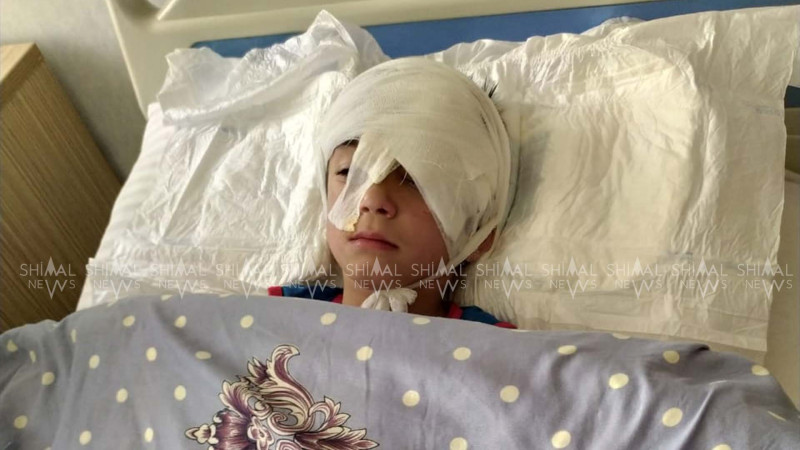 Qubada küçə iti iki qadını və bir azyaşlını dişlədi - FOTO- YENİLƏNİB