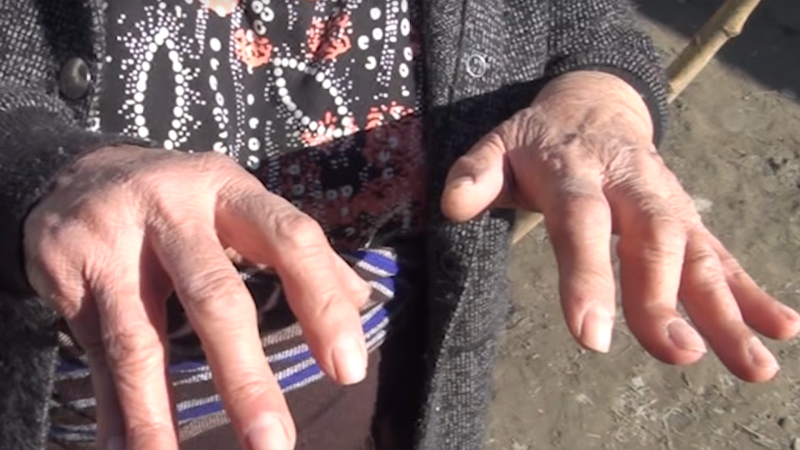 Şəkidə ürək dağlayan mənzərə: Xəstə övladlar, uçan ev, çıxılmaz durum