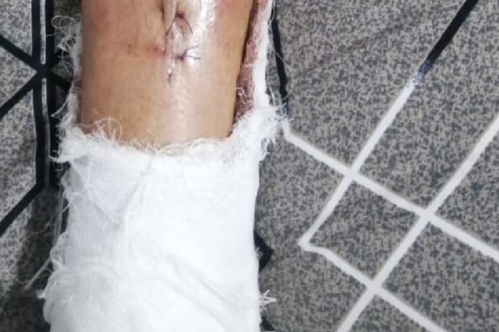 Qubada zədə alan azyaşlının ailəsi: Günahkar cəzalandırılsın