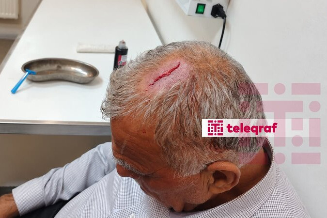 Şəkidə icra nümayəndəsi bələdiyyə sədrinin başına butulka çırpdı