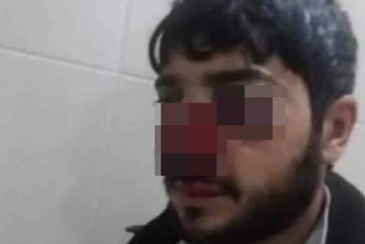 Quba: meşəbəyinin döyülməsi barədə qurumlardan açıqlama verilib