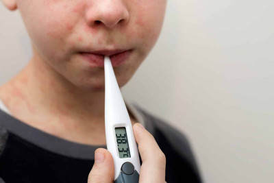 Xaçmazda 21 nəfər qızılcaya yoluxub