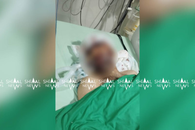 Quba-Qusar yolunda qəzaya düşən şəxsin vəziyyəti ağırdır