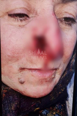 Qubada küçə itləri dəhşət saçdı-FOTO-YENİLƏNİB