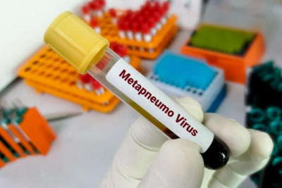 Metapnevmavirusa yoluxma ilə bağlı RƏSMİ AÇIQLAMA