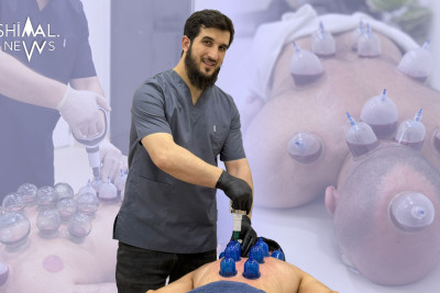 “İki xərçəng xəstəsi hicama ilə sağaldı” - Haldun Məmmədli ilə ÖZƏL MÜSAHİBƏ