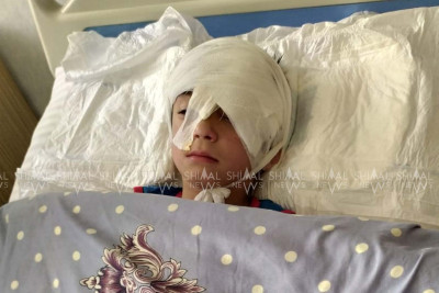 Qubada küçə iti iki qadını və bir azyaşlını dişlədi - FOTO- YENİLƏNİB