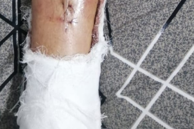 Qubada zədə alan azyaşlının ailəsi: Günahkar cəzalandırılsın